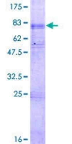 Novus Biologicals Recombinant Human OCTN2/SLC22A5 GST (N-Term) Protein 2 &mu;g | Buy Online | Novus Biologicals&trade; | Fisher Scientific
