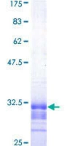 Novus Biologicals Recombinant Human OCTN2/SLC22A5 GST (N-Term) Protein 10 &mu;g | Buy Online | Novus Biologicals&trade; | Fisher Scientific