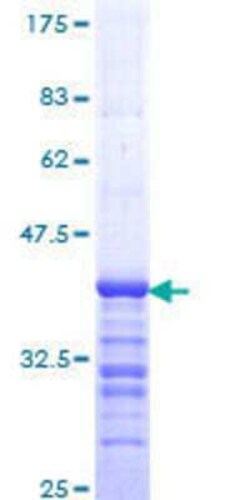 Novus Biologicals Recombinant Human SNF5 GST (N-Term) Protein 10 &mu;g | Buy Online | Novus Biologicals&trade; | Fisher Scientific