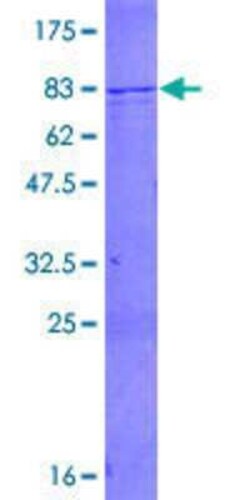 Novus Biologicals Recombinant Human SMARCD1 GST (N-Term) Protein 2 &mu;g | Buy Online | Novus Biologicals&trade; | Fisher Scientific
