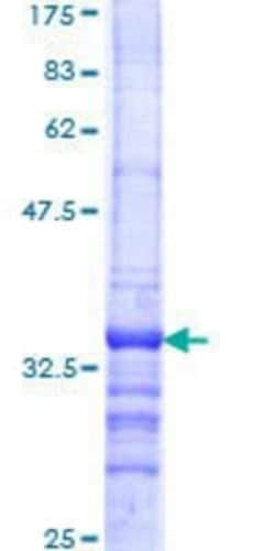 Novus Biologicals Recombinant Human SMARCD2 GST (N-Term) Protein 10 &mu;g | Buy Online | Novus Biologicals&trade; | Fisher Scientific