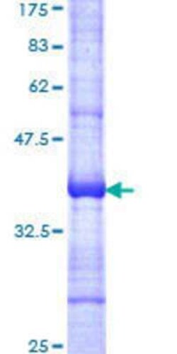 Novus Biologicals Recombinant Human SMARCD3 GST (N-Term) Protein 10 &mu;g | Buy Online | Novus Biologicals&trade; | Fisher Scientific