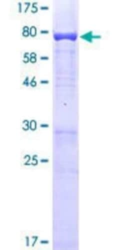 Novus Biologicals Recombinant Human BAF57 GST (N-Term) Protein 10 &mu;g | Buy Online | Novus Biologicals&trade; | Fisher Scientific
