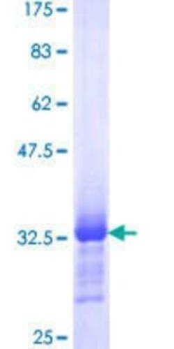 Novus Biologicals Recombinant Human BAF57 GST (N-Term) Protein 10 &mu;g | Buy Online | Novus Biologicals&trade; | Fisher Scientific