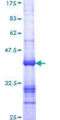 Novus Biologicals Recombinant Human SMN2 GST (N-Term) Protein 10 &mu;g | Buy Online | Novus Biologicals&trade; | Fisher Scientific