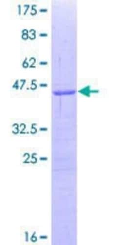 Novus Biologicals Recombinant Human Smoothened GST (N-Term) Protein 10 &mu;g | Buy Online | Novus Biologicals&trade; | Fisher Scientific