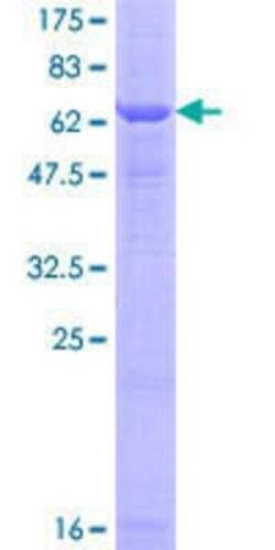 Novus Biologicals Recombinant Human nSMase GST (N-Term) Protein 25 &mu;g | Buy Online | Novus Biologicals&trade; | Fisher Scientific
