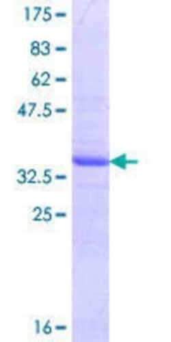 Novus Biologicals Recombinant Human SNAPC3 GST (N-Term) Protein 10 &mu;g | Buy Online | Novus Biologicals&trade; | Fisher Scientific