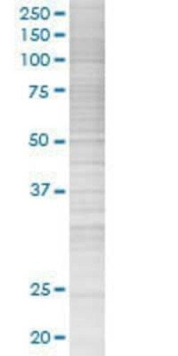 Novus Biologicals gamma-Synuclein 293T Cell Transient Overexpression Lysate 0.1 mL | Buy Online | Novus Biologicals&trade; | Fisher Scientific