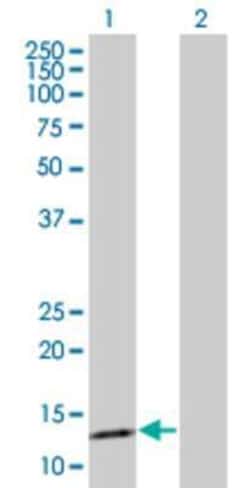 Novus Biologicals gamma-Synuclein 293T Cell Transient Overexpression Lysate 0.1 mL | Buy Online | Novus Biologicals&trade; | Fisher Scientific