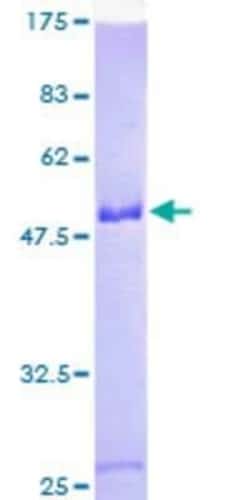 Novus Biologicals Recombinant Human SNRP70 GST (N-Term) Protein 10 &mu;g | Buy Online | Novus Biologicals&trade; | Fisher Scientific