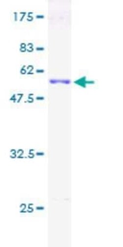 Novus Biologicals Recombinant Human SNRPN GST (N-Term) Protein 2 &mu;g | Buy Online | Novus Biologicals&trade; | Fisher Scientific