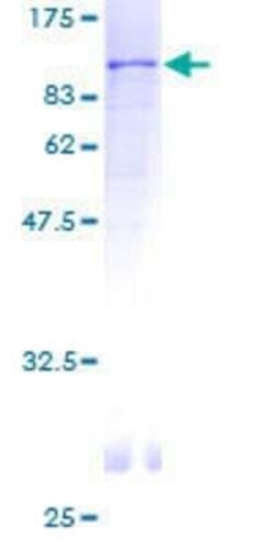 Novus Biologicals Recombinant Human SNX2 GST (N-Term) Protein 2 &mu;g | Buy Online | Novus Biologicals&trade; | Fisher Scientific