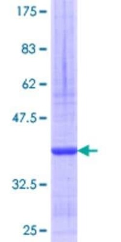Novus Biologicals Recombinant Human SNTB2 GST (N-Term) Protein 10 &mu;g | Buy Online | Novus Biologicals&trade; | Fisher Scientific