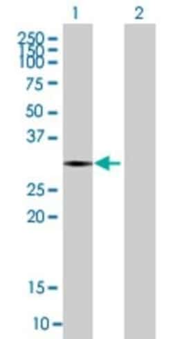 Novus Biologicals SNTB2 293T Cell Transient Overexpression Lysate 0.1 mL | Buy Online | Novus Biologicals&trade; | Fisher Scientific