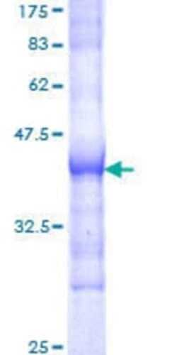 Novus Biologicals Recombinant Human SOS1 GST (N-Term) Protein 10 &mu;g | Buy Online | Novus Biologicals&trade; | Fisher Scientific