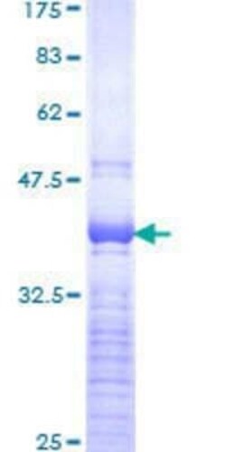 Novus Biologicals Recombinant Human SOX4 GST (N-Term) Protein 10 &mu;g | Buy Online | Novus Biologicals&trade; | Fisher Scientific