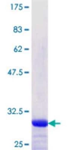 Novus Biologicals Recombinant Human SOX5 GST (N-Term) Protein 25 &mu;g | Buy Online | Novus Biologicals&trade; | Fisher Scientific