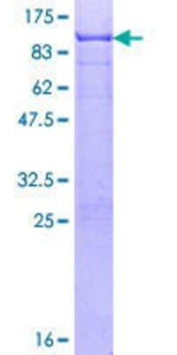 Novus Biologicals Recombinant Human SOX9 GST (N-Term) Protein 10 &mu;g | Buy Online | Novus Biologicals&trade; | Fisher Scientific