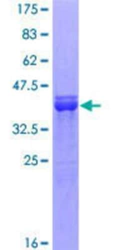 Novus Biologicals Recombinant Human SOX9 GST (N-Term) Protein 25 &mu;g | Buy Online | Novus Biologicals&trade; | Fisher Scientific
