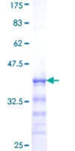 Novus Biologicals Recombinant Human SOX10 GST (N-Term) Protein 10 &mu;g | Buy Online | Novus Biologicals&trade; | Fisher Scientific