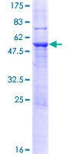 Novus Biologicals Recombinant Human SP2 GST (N-Term) Protein 25 &mu;g | Buy Online | Novus Biologicals&trade; | Fisher Scientific