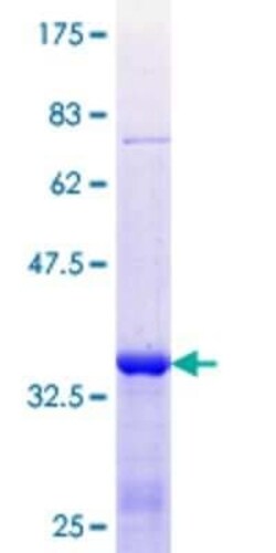 Novus Biologicals Recombinant Human SP2 GST (N-Term) Protein 25 &mu;g | Buy Online | Novus Biologicals&trade; | Fisher Scientific