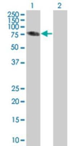 Novus Biologicals SP100 293T Cell Transient Overexpression Lysate 0.1 mL | Buy Online | Novus Biologicals&trade; | Fisher Scientific