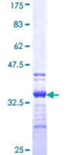 Novus Biologicals Recombinant Human SPAG1 GST (N-Term) Protein 25 &mu;g | Buy Online | Novus Biologicals&trade; | Fisher Scientific