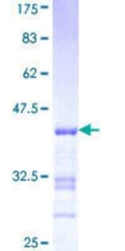 Novus Biologicals Recombinant Human UAP1 GST (N-Term) Protein 25 &mu;g | Buy Online | Novus Biologicals&trade; | Fisher Scientific