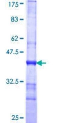 Novus Biologicals Recombinant Human SPAG4 GST (N-Term) Protein 10 &mu;g | Buy Online | Novus Biologicals&trade; | Fisher Scientific