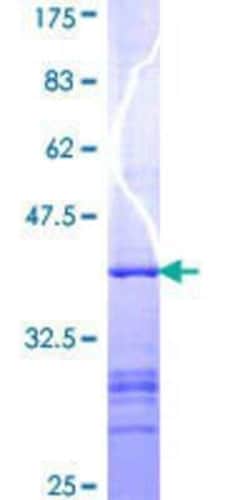 Novus Biologicals Recombinant Human SPG7 GST (N-Term) Protein 25 &mu;g | Buy Online | Novus Biologicals&trade; | Fisher Scientific
