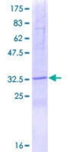 Novus Biologicals Recombinant Human SPINK2 GST (N-Term) Protein 2 &mu;g | Buy Online | Novus Biologicals&trade; | Fisher Scientific