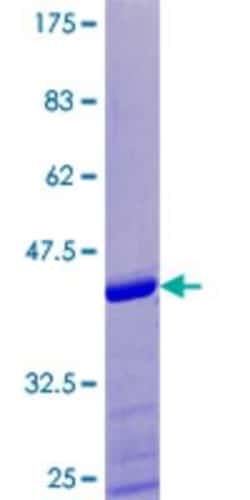 Novus Biologicals Recombinant Human SPRR1A GST (N-Term) Protein 10 &mu;g | Buy Online | Novus Biologicals&trade; | Fisher Scientific