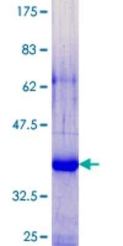 Novus Biologicals Recombinant Human SPRR2G GST (N-Term) Protein 25 &mu;g | Buy Online | Novus Biologicals&trade; | Fisher Scientific
