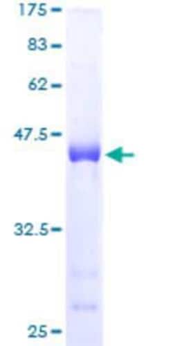 Novus Biologicals&trade;&nbsp;Recombinant Human SPRR3 GST (N-Term) Protein