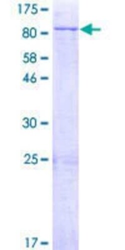 Novus Biologicals Recombinant Human SQLE GST (N-Term) Protein 2 &mu;g | Buy Online | Novus Biologicals&trade; | Fisher Scientific