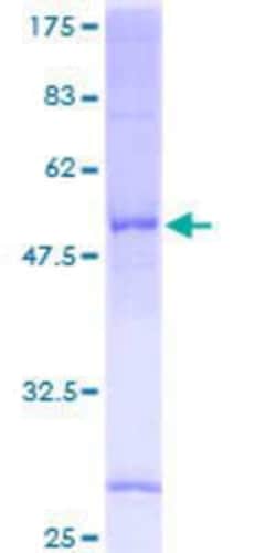 Novus Biologicals Recombinant Human SRD5A1 GST (N-Term) Protein 2 &mu;g | Buy Online | Novus Biologicals&trade; | Fisher Scientific