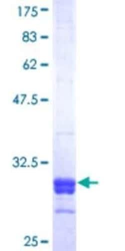 Novus Biologicals Recombinant Human SRD5A2 GST (N-Term) Protein 10 &mu;g | Buy Online | Novus Biologicals&trade; | Fisher Scientific