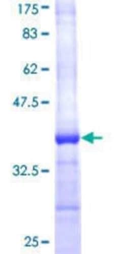 Novus Biologicals Recombinant Human SREBP2 GST (N-Term) Protein 10 &mu;g | Buy Online | Novus Biologicals&trade; | Fisher Scientific