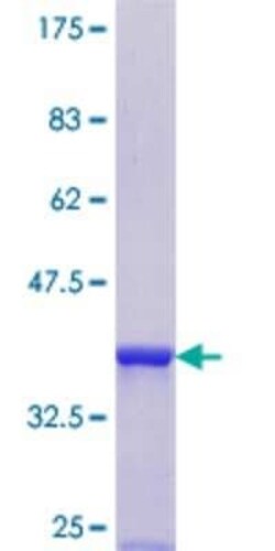 Novus Biologicals Recombinant Human SRP54 GST (N-Term) Protein 25 &mu;g | Buy Online | Novus Biologicals&trade; | Fisher Scientific