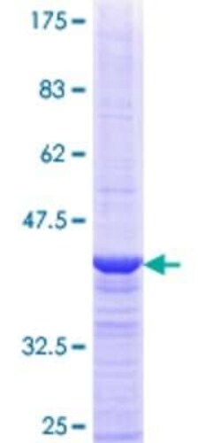 Novus Biologicals Recombinant Human SRP68 GST (N-Term) Protein 25 &mu;g | Buy Online | Novus Biologicals&trade; | Fisher Scientific