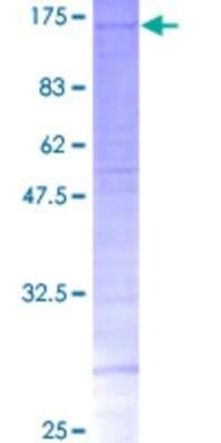 Novus Biologicals Recombinant Human SRPK2 GST (N-Term) Protein 25 &mu;g | Buy Online | Novus Biologicals&trade; | Fisher Scientific