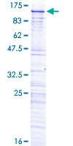 Novus Biologicals Recombinant Human SRPK2 GST (N-Term) Protein 25 &mu;g | Buy Online | Novus Biologicals&trade; | Fisher Scientific