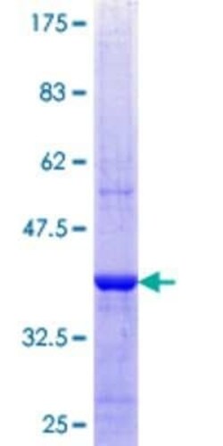Novus Biologicals Recombinant Human SRPK2 GST (N-Term) Protein 25 &mu;g | Buy Online | Novus Biologicals&trade; | Fisher Scientific