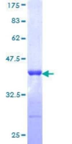 Novus Biologicals Recombinant Human TRIM21/SSA1 GST (N-Term) Protein 10 &mu;g | Buy Online | Novus Biologicals&trade; | Fisher Scientific