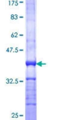 Novus Biologicals Recombinant Human TROVE2 GST (N-Term) Protein 10 &mu;g | Buy Online | Novus Biologicals&trade; | Fisher Scientific