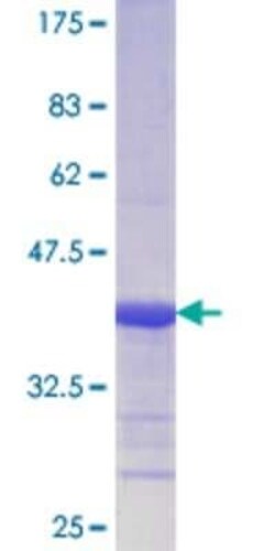 Novus Biologicals Recombinant Human SSB GST (N-Term) Protein 10 &mu;g | Buy Online | Novus Biologicals&trade; | Fisher Scientific
