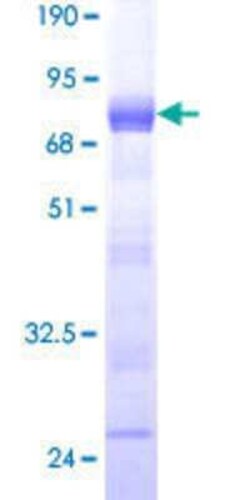 Novus Biologicals Recombinant Human SSFA2 GST (N-Term) Protein 10 &mu;g | Buy Online | Novus Biologicals&trade; | Fisher Scientific