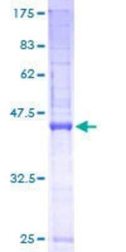 Novus Biologicals Recombinant Human SSR3 GST (N-Term) Protein 10 &mu;g | Buy Online | Novus Biologicals&trade; | Fisher Scientific